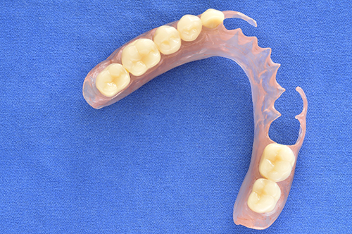 Removable Dentures 20010